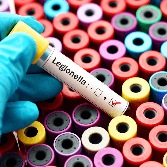 Legionella risk assessment service